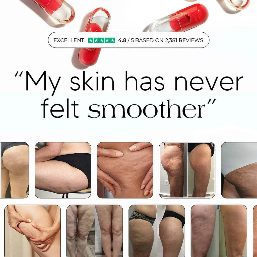Maximum Potency Anti-Cellulite & Lipedema Capsules | Smooth Skin by Flowvital™